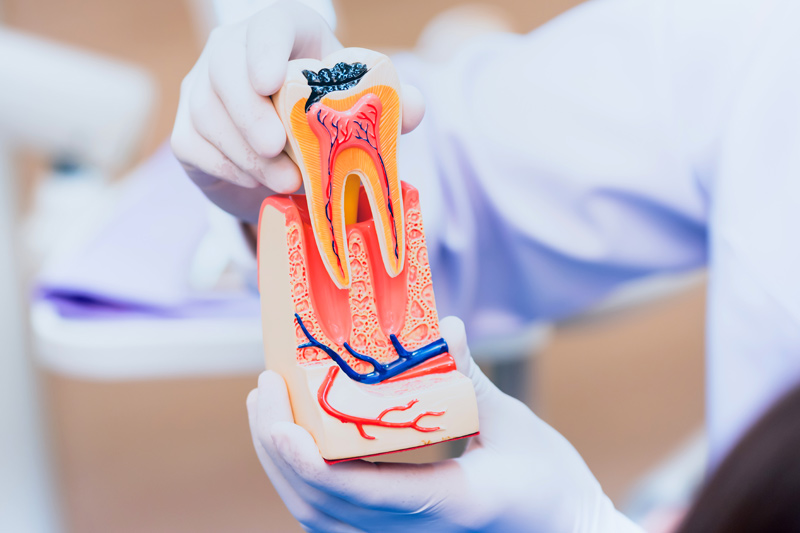 Leczenie kanałowe – endodontyczne model zębowy